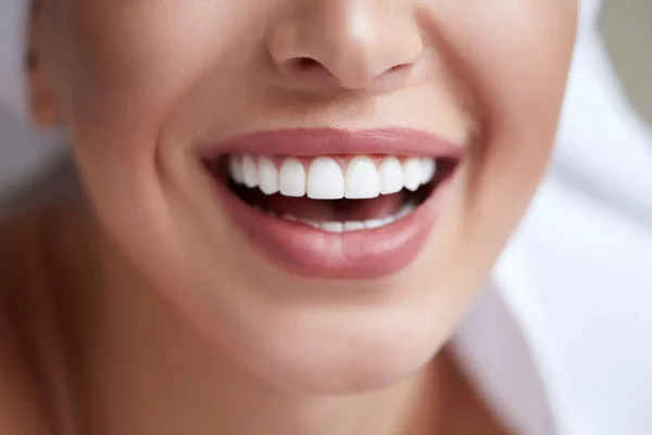 Porcelain Veneers