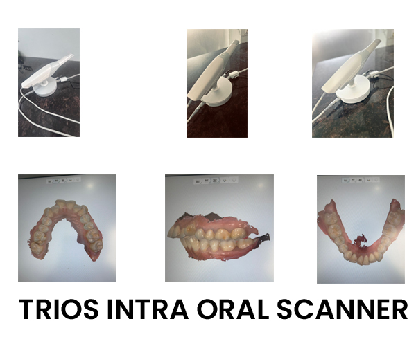 TRIOS INTRA ORAL SCANNER