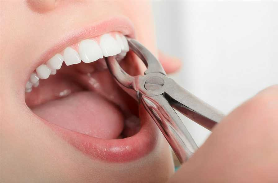 Tooth Extraction Clinic