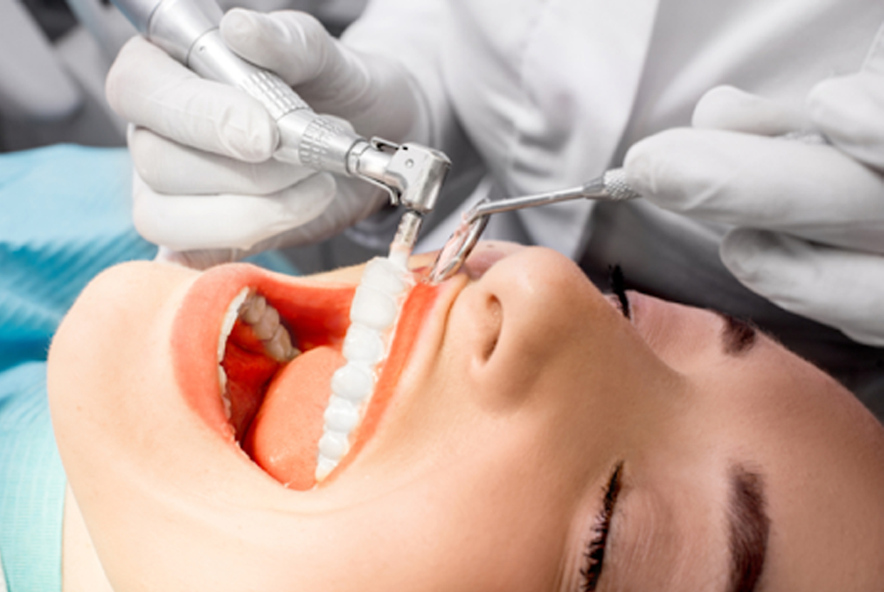 Teeth Scaling Treatment