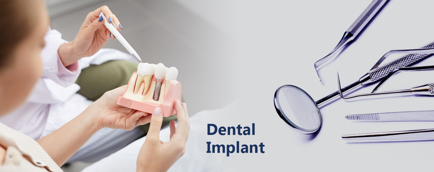 dental implants